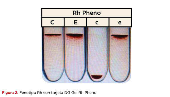 Figura 2. Fenotipo Rh con tarjeta DG Gel Rh Pheno