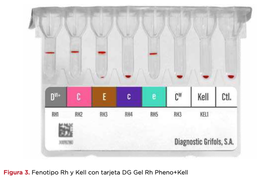 Figura 3. Fenotipo Rh y Kell con tarjeta DG Gel Rh Pheno+Kell