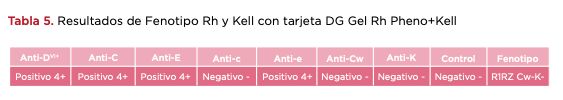 Tabla 5. Resultados de Fenotipo Rh y Kell con tarjeta DG Gel Rh Pheno+Kell
